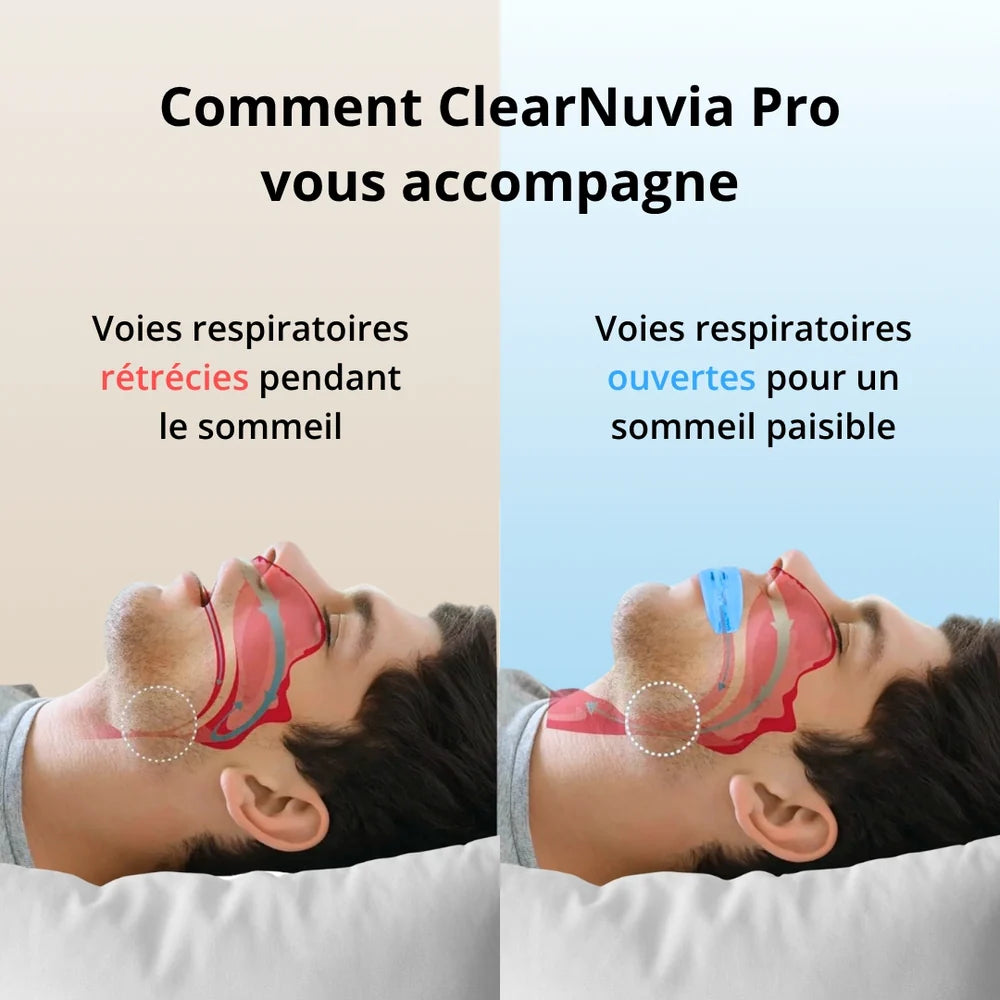 ClearNuvia Pro® Appareil buccal anti-ronflement