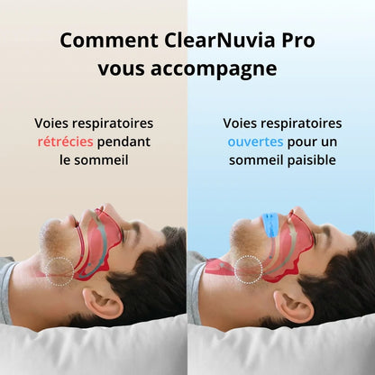 ClearNuvia Pro® Appareil buccal anti-ronflement